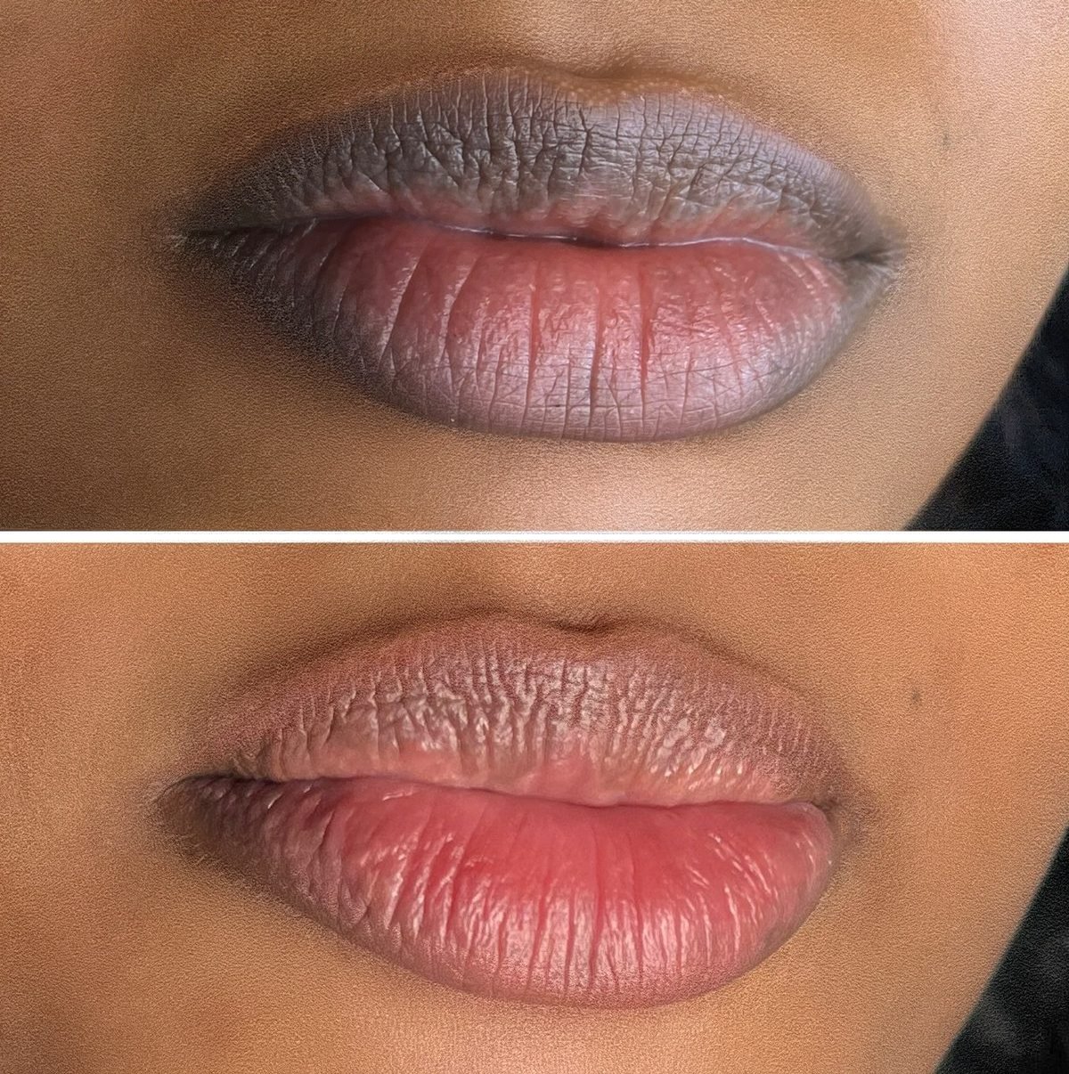 Before and after Dark Lip Neutralisation by Kate Dark