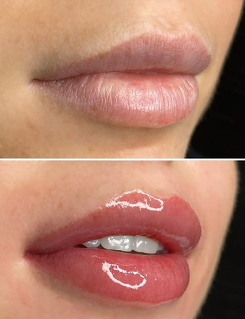 Before and after Lip Blush by Kate Dark